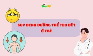 suy dinh dưỡng thể teo đét ở trẻ